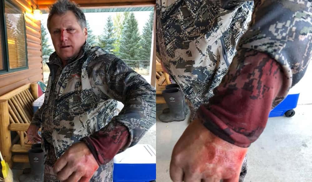 Idaho Bowhunter Survived a Grizzly Bear Attack in ...
