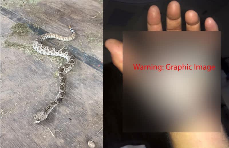 Country Singer Kevin Fowler Shares Picture of a Rattlesnake Bite
