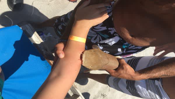 Florida Woman Arrives in Hospital with Dead Shark Biting Her Arm