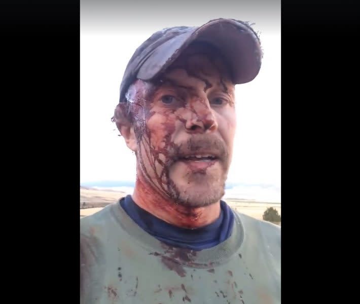 Graphic Video: Man Got Mauled by Grizzly and Survived