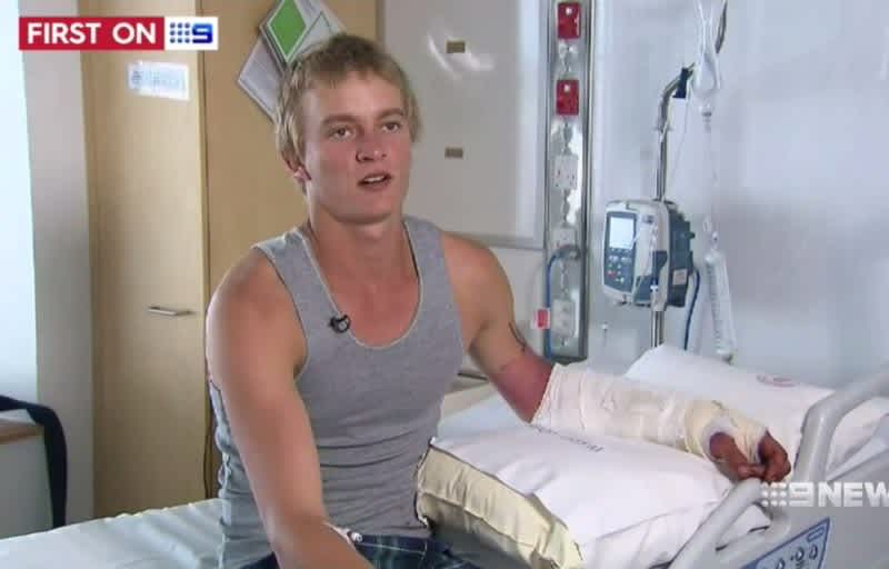 Video: Australian Teenager Nearly Gets Arm Ripped Off by Crocodile to ‘Impress a Girl”
