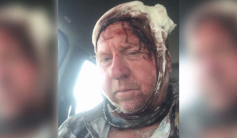 Elk Hunter has Gruesome Run-In with an Angry Grizzly Bear