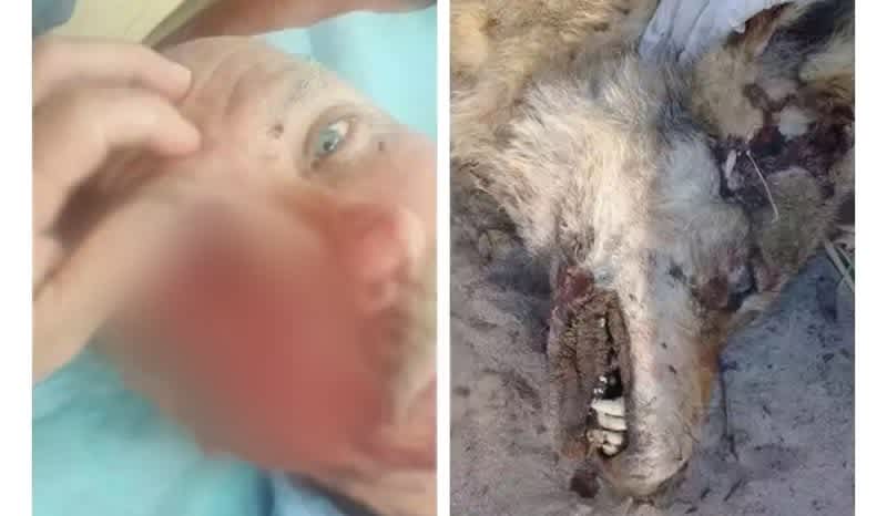 GRAPHIC: Fisherman Attacked by Wolf in Kazakhstan Suffers Brutal Face Injury