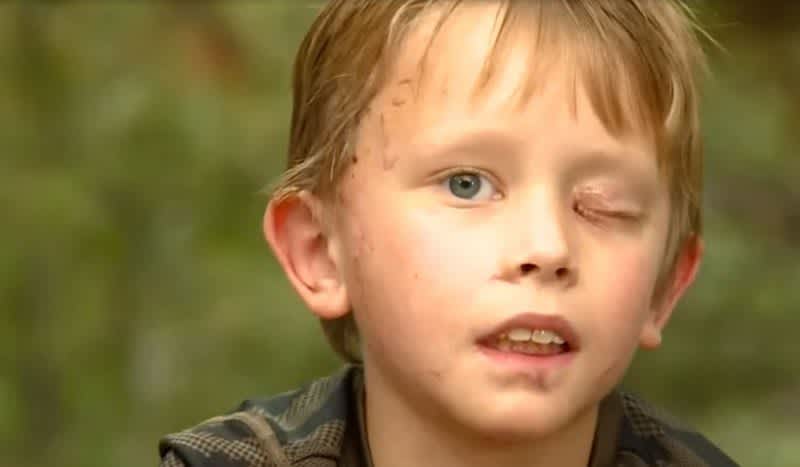 8-Year-Old Colorado Boy Recovering from Backyard Mountain Lion Attack Shares Terrifying Story