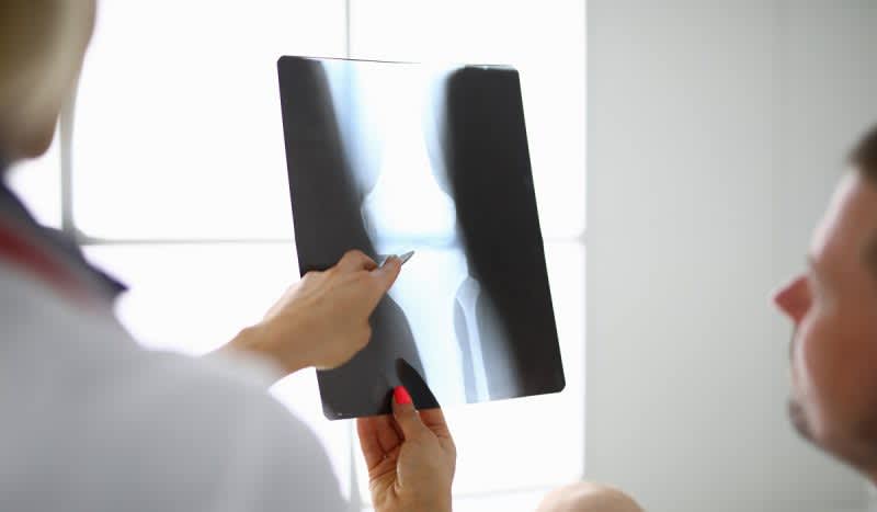 Study Shows Vegan Diet Linked With Higher Risk of Bone Fractures