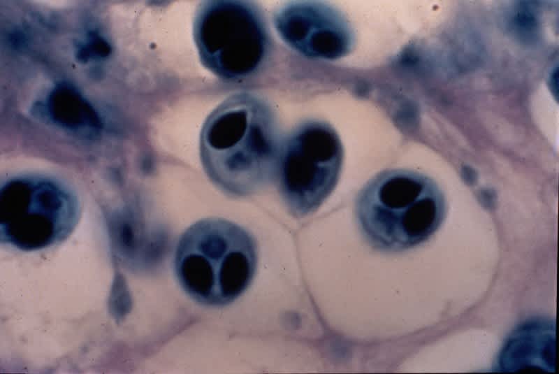 These alien-like spores can cause whirling disease, which causes heavy fatalities in fish. Image is public domain.